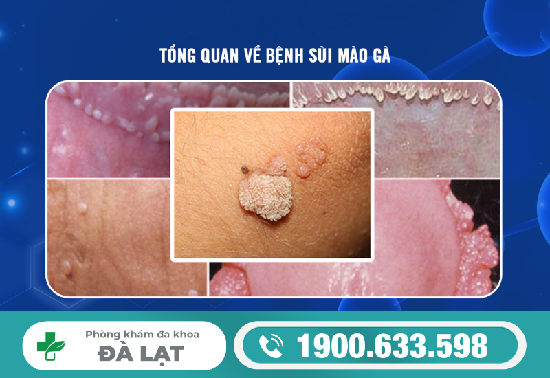 Hình ảnh minh họa